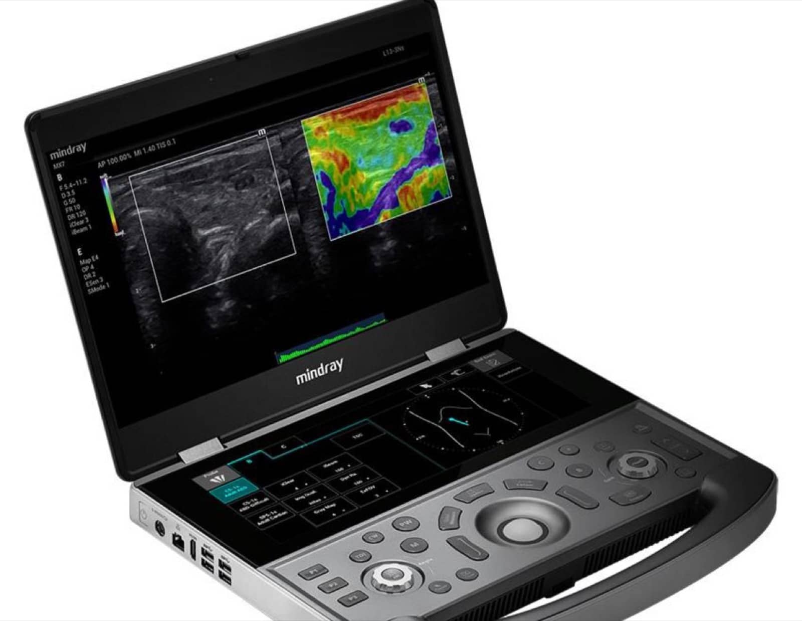 State of the art venous duplex ultrasound and vein ablation equipment